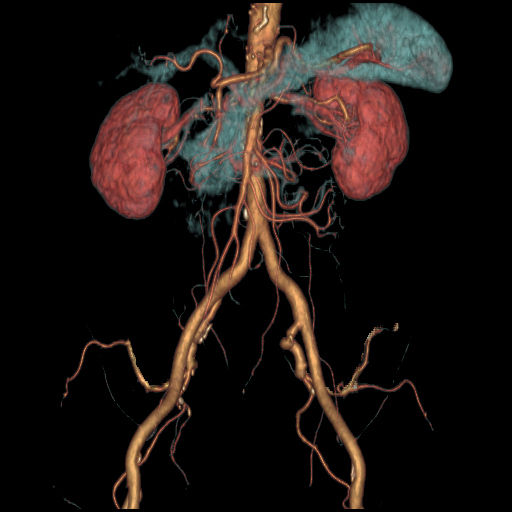 ories-computed-tomography-discoverygsi-imagegallery-body-revolution-gsi-body-image33