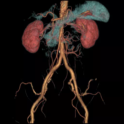 ories-computed-tomography-discoverygsi-imagegallery-body-revolution-gsi-body-image33