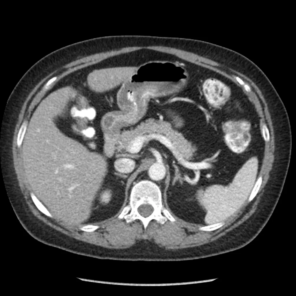 ories-computed-tomography-discoverygsi-imagegallery-body-revolution-gsi-body-image35