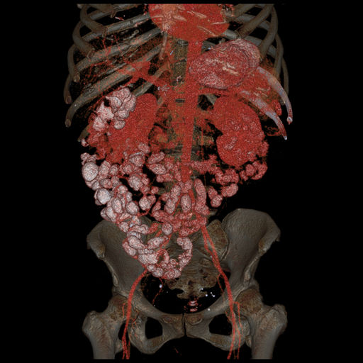 ories-computed-tomography-discoverygsi-imagegallery-body-revolution-gsi-body-image36