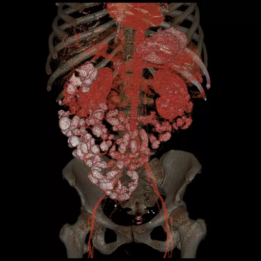 ories-computed-tomography-discoverygsi-imagegallery-body-revolution-gsi-body-image36