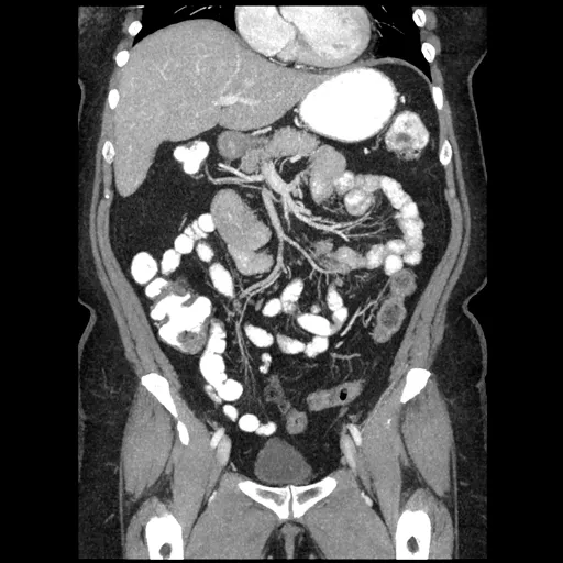 ories-computed-tomography-discoverygsi-imagegallery-body-revolution-gsi-body-image37