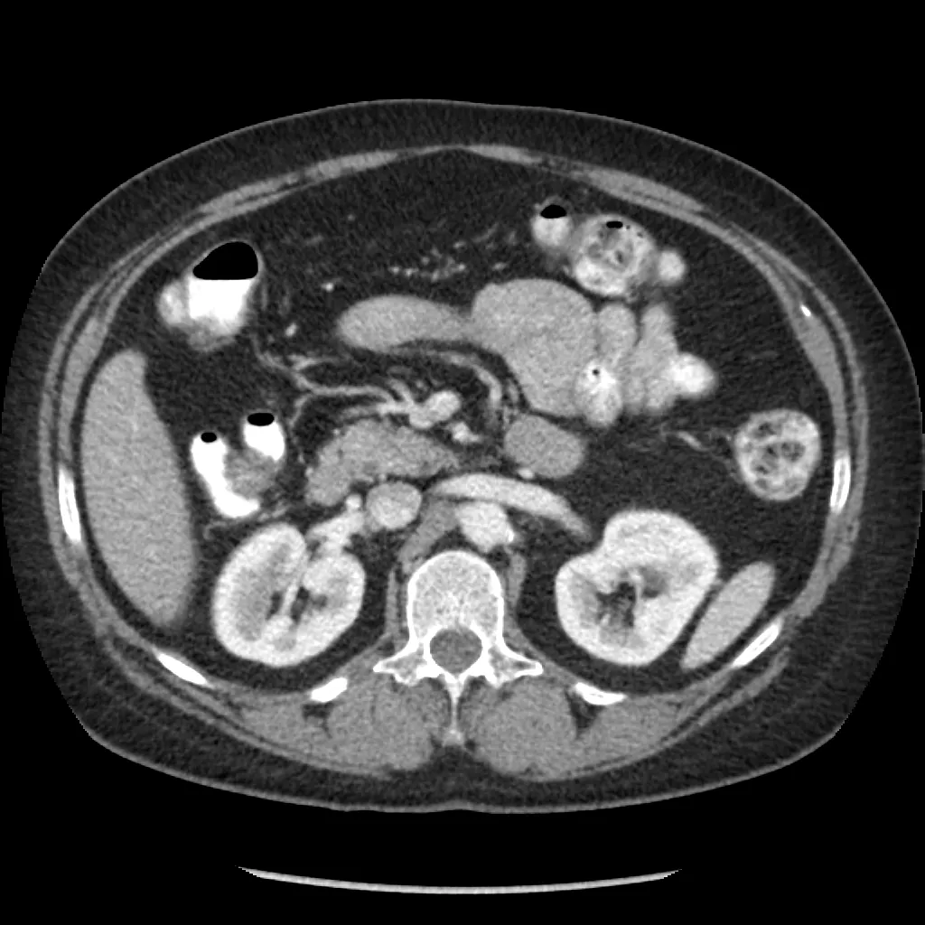 ories-computed-tomography-discoverygsi-imagegallery-body-revolution-gsi-body-image38