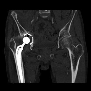 ories-computed-tomography-discoverygsi-imagegallery-body-revolution-gsi-body-imagem3