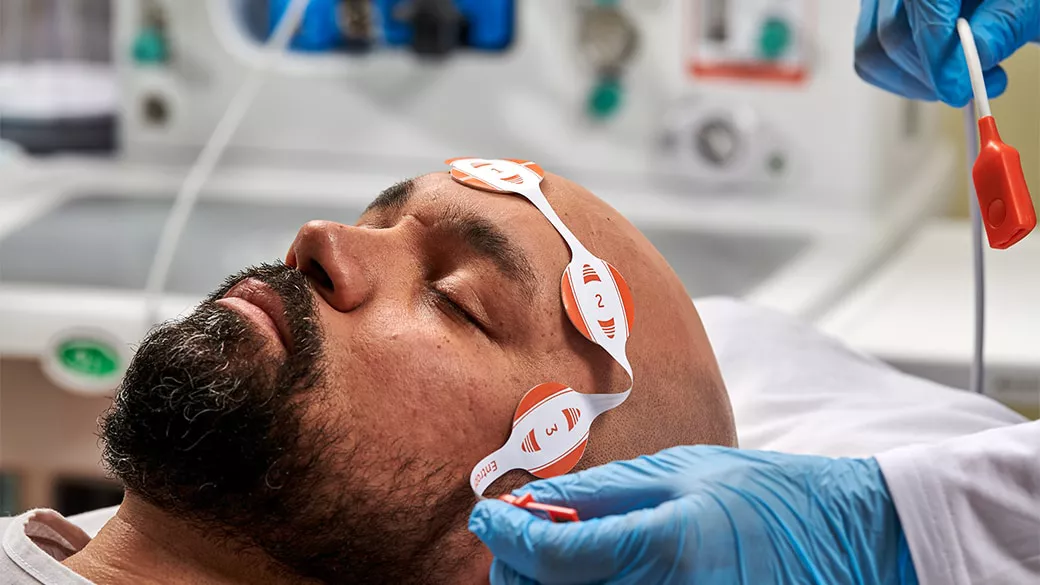 Patient with entropy monitoring sensors on their forehead.