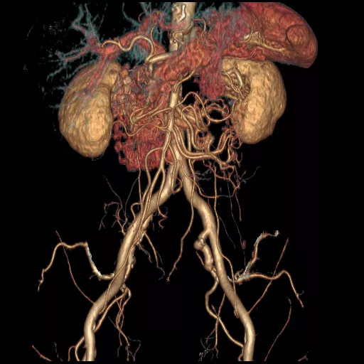 ries-computed-tomography-discoverygsi-imagegallery-body-revolution-gsi-body-image34