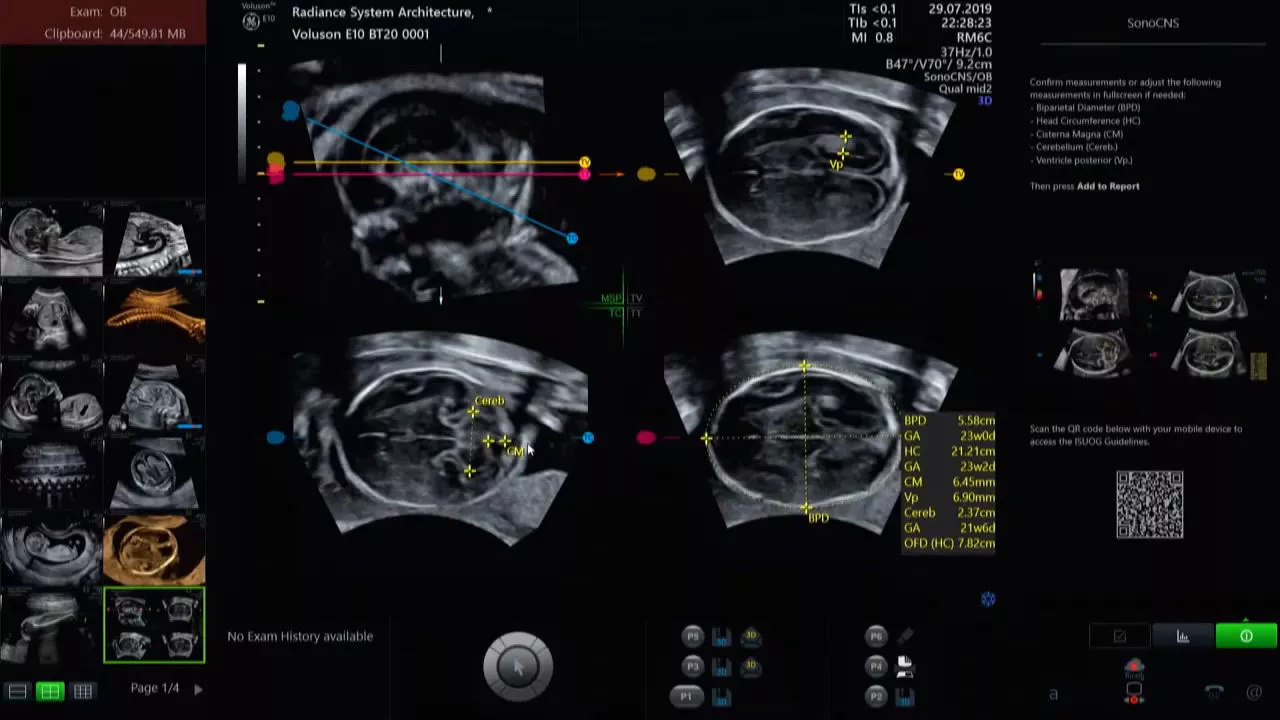 sonocns-demo-video-2020