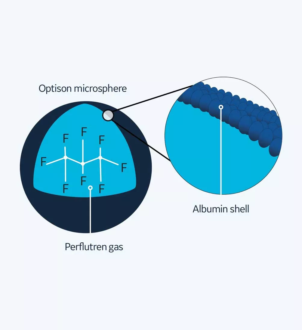 structure-optison-microsphere-vi-en