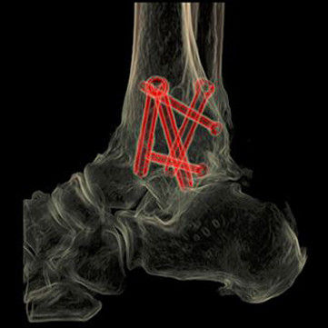 t-categories-computed-tomography-revolutionhd-gehc-revolution-hd-clinical-images-msk1