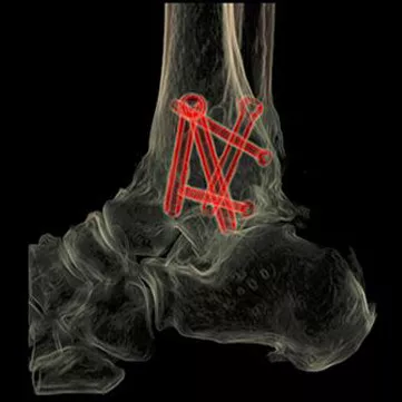 t-categories-computed-tomography-revolutionhd-gehc-revolution-hd-clinical-images-msk1