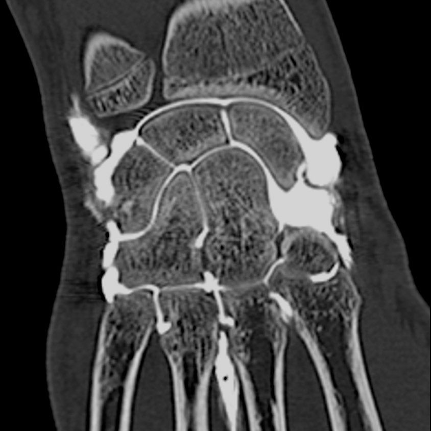 t-categories-computed-tomography-revolutionhd-gehc-revolution-hd-clinical-images-msk2