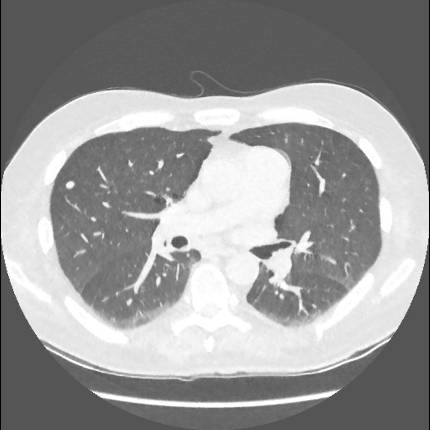 t-categories-computed-tomography-revolutionhd-gehc-revolution-hd-clinical-images-veo3