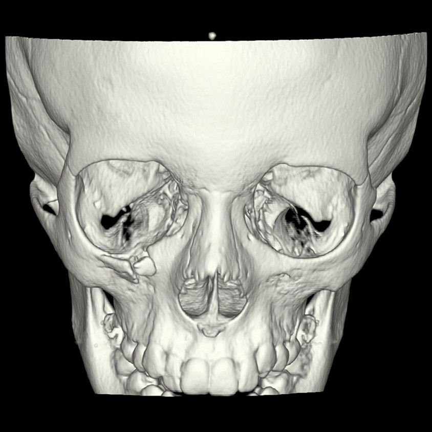 t-categories-computed-tomography-revolutionhd-gehc-revolution-hd-clinical-images-veo4