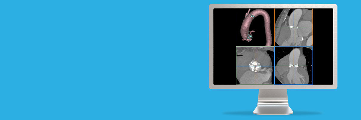 t-clone-advanced-visualization-applications-valve-planning-aw-valve-planning_spotlight.jpg