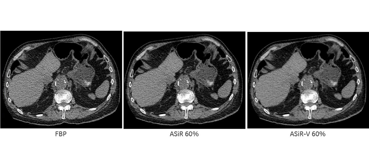 uct-computed-tomography-discoverygsi-imagegallery-asir-v-asir-v1