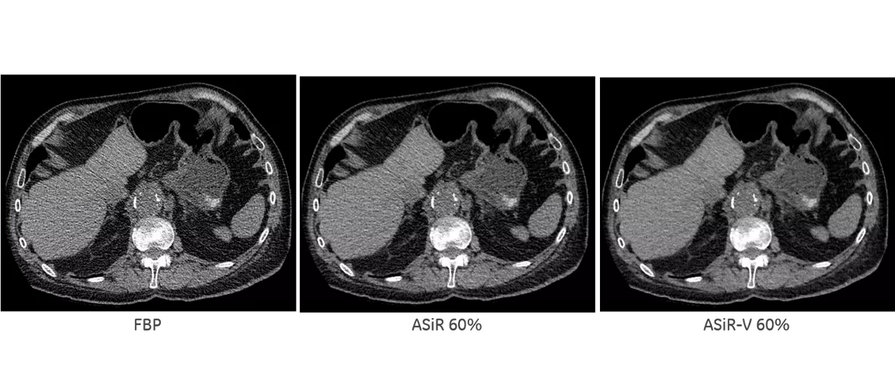 uct-computed-tomography-discoverygsi-imagegallery-asir-v-asir-v1