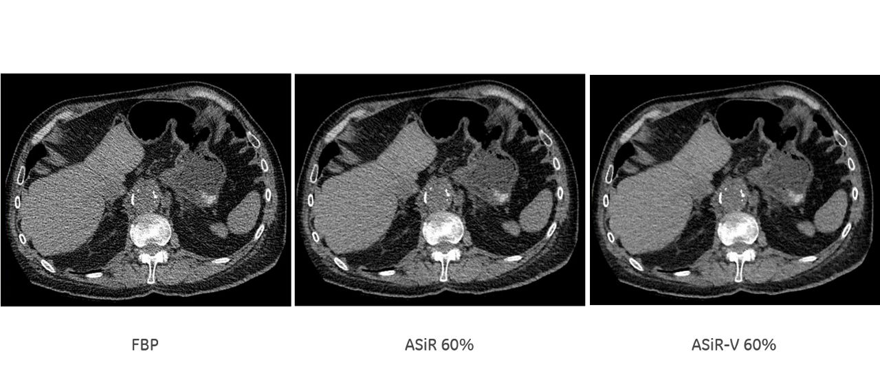uct-computed-tomography-discoverygsi-imagegallery-asir-v-asir-v2