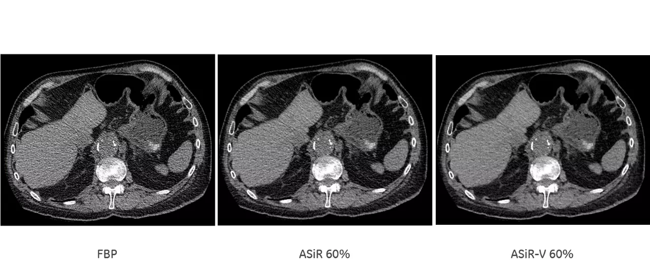 uct-computed-tomography-discoverygsi-imagegallery-asir-v-asir-v2