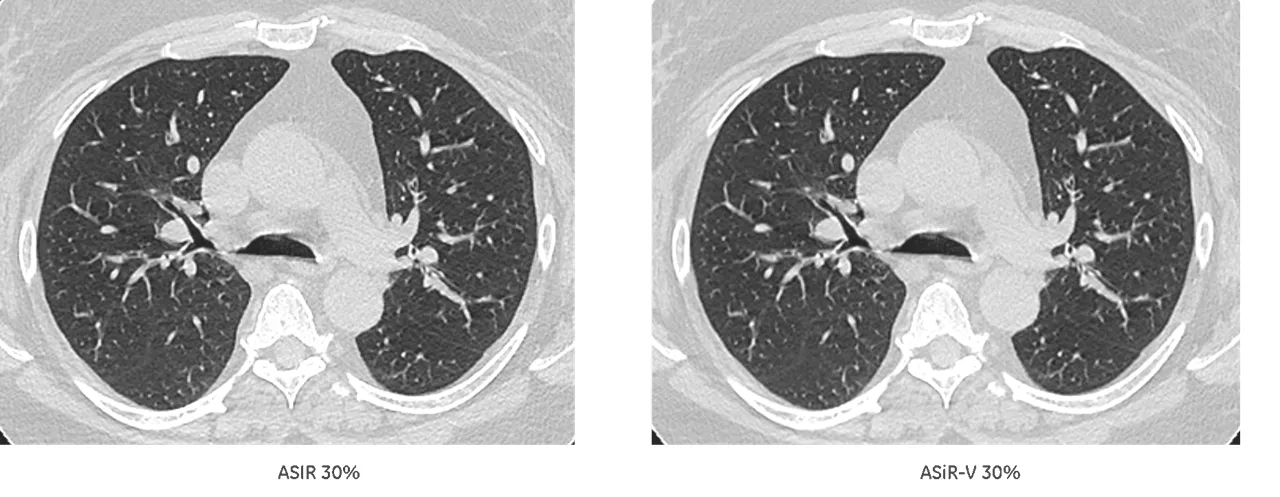 uct-computed-tomography-discoverygsi-imagegallery-asir-v-asir-v3