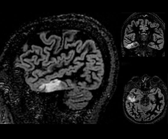 ultrasound-signaarchitect-clinicalimages-neuroworks-cubedir