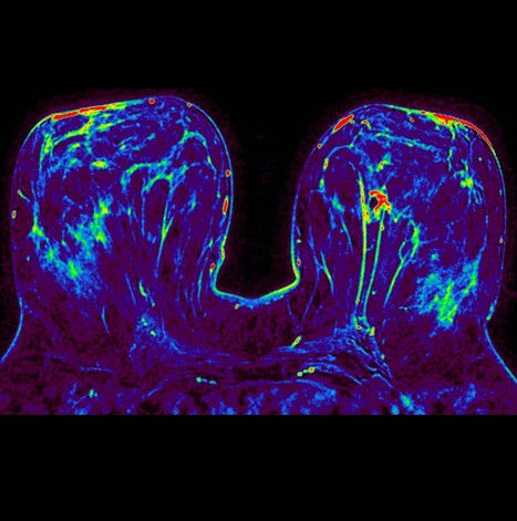 ultrasound-signaarchitect-clinicalimages-oncoworks-fspgraxdynamic