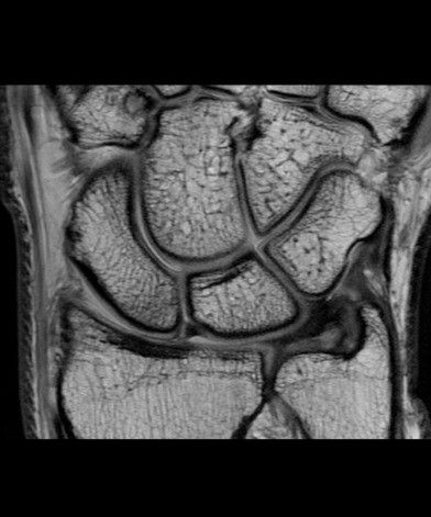 ultrasound-signaarchitect-clinicalimages-orthoworks-pdfatsatcornal