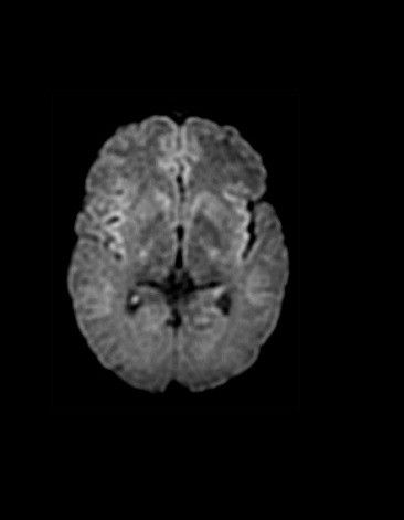ultrasound-signaarchitect-clinicalimages-silentworks-silent-dwi