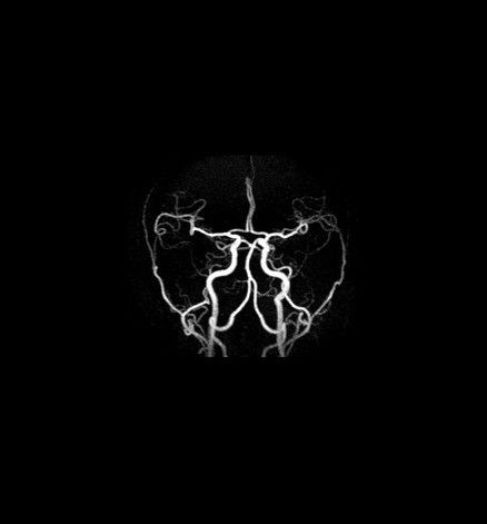 ultrasound-signaarchitect-clinicalimages-silentworks-silentmra