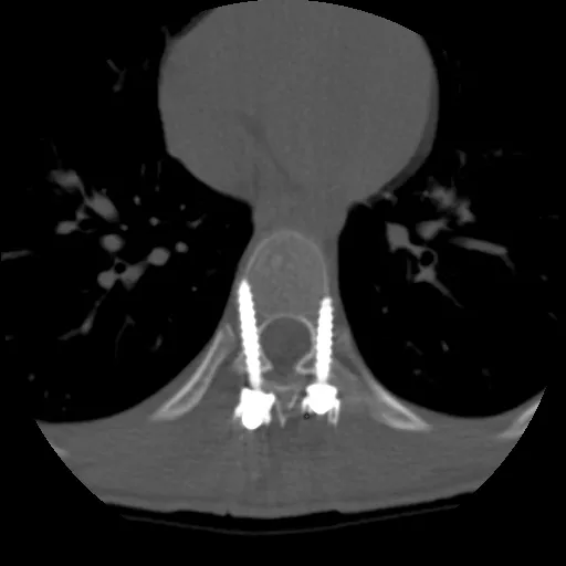 uted-tomography-discoverygsi-imagegallery-musculoskeletal-revolution-gsi-msk-image41