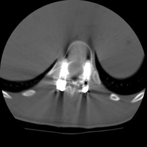 uted-tomography-discoverygsi-imagegallery-musculoskeletal-revolution-gsi-msk-image42