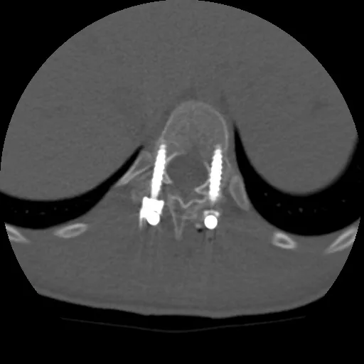 uted-tomography-discoverygsi-imagegallery-musculoskeletal-revolution-gsi-msk-image43