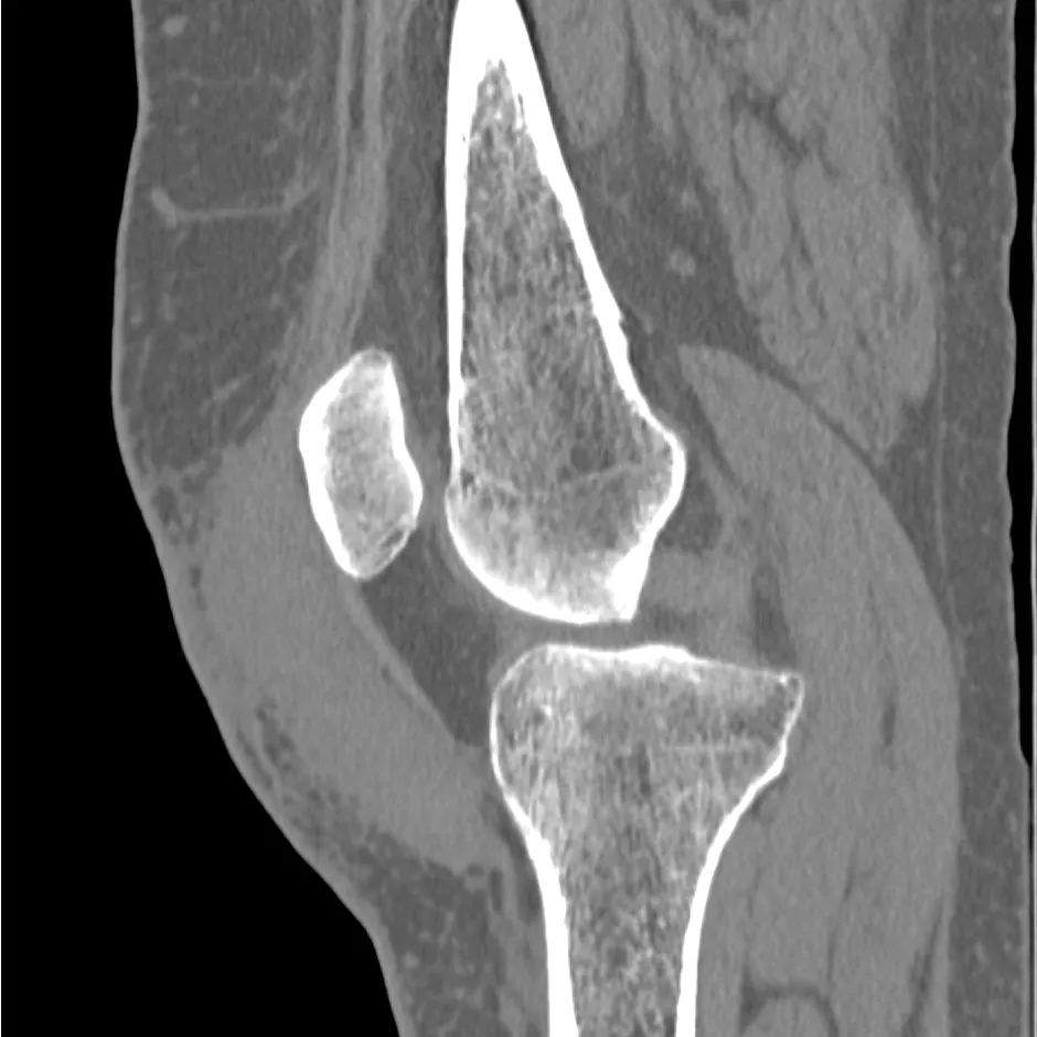 uted-tomography-discoverygsi-imagegallery-musculoskeletal-revolution-gsi-msk-image47