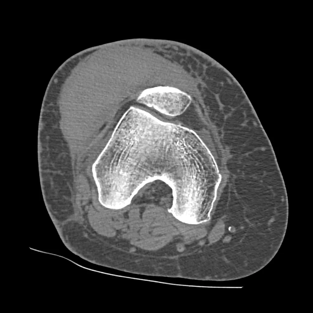 uted-tomography-discoverygsi-imagegallery-musculoskeletal-revolution-gsi-msk-image48