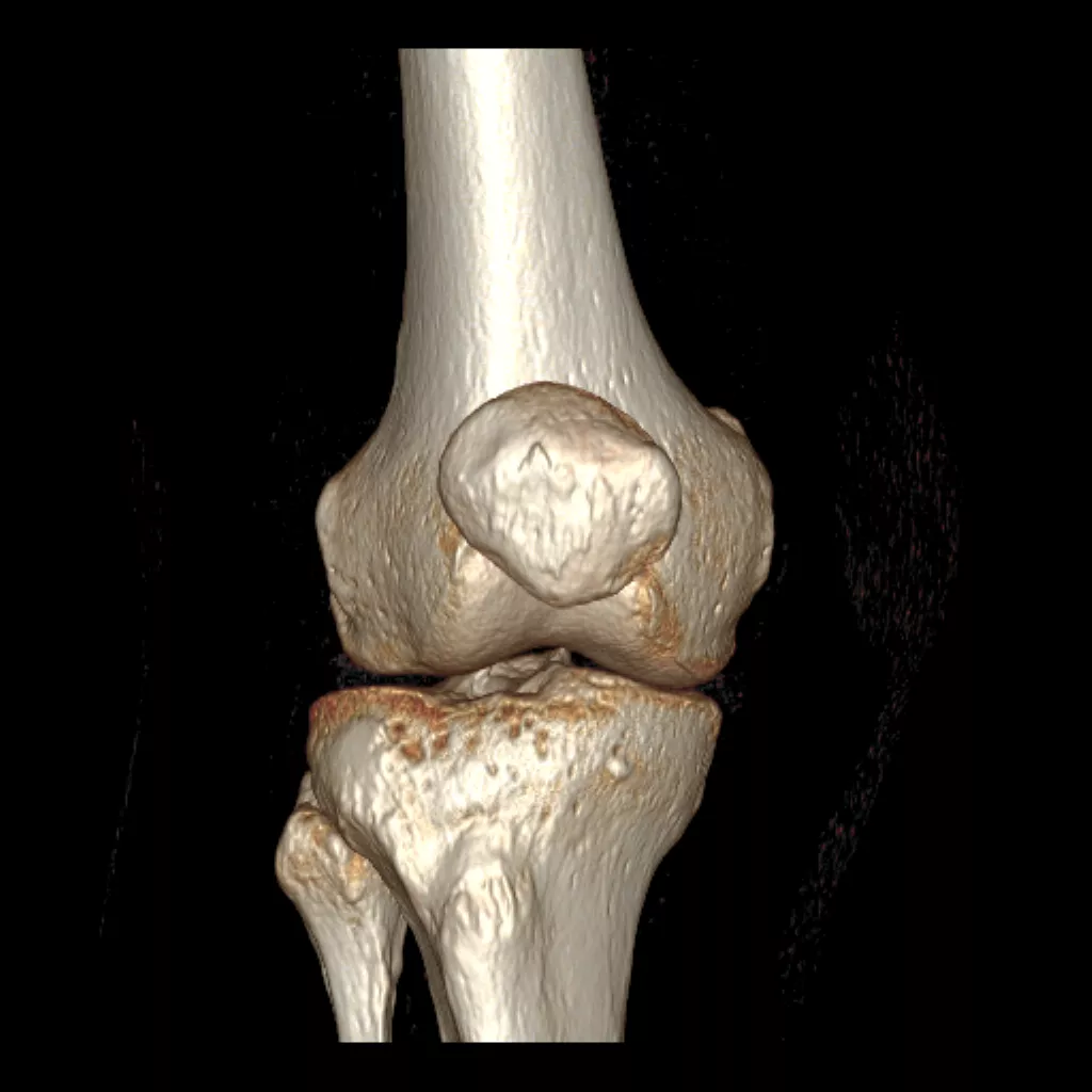 uted-tomography-discoverygsi-imagegallery-musculoskeletal-revolution-gsi-msk-image49