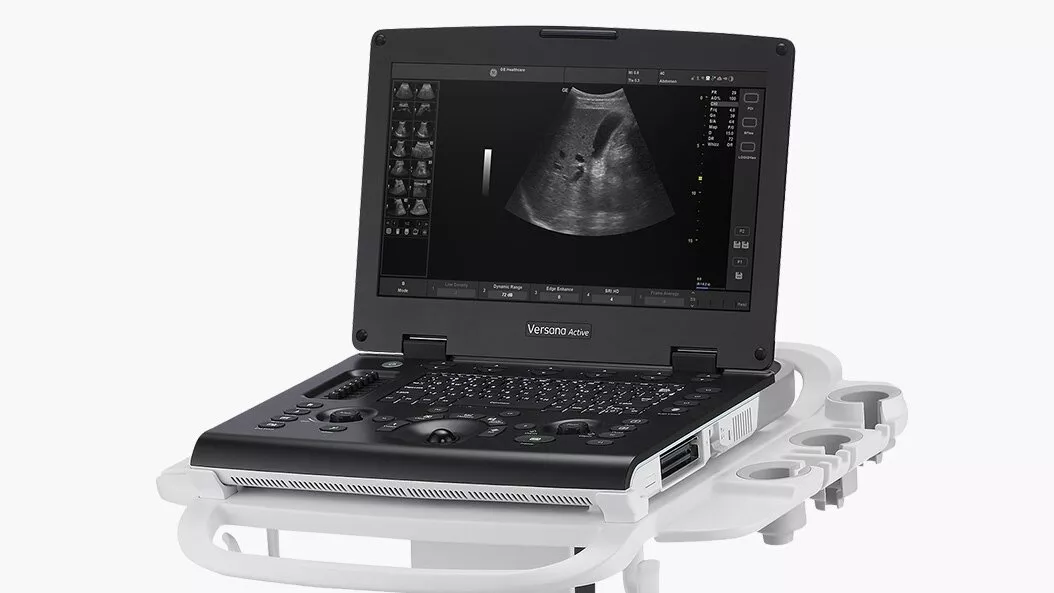 versana-ultrasound-systems-active-en