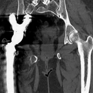 ygsi-imagegallery-musculoskeletal-gehc-revolution-gsi-clinical-image-msk-120kvimage