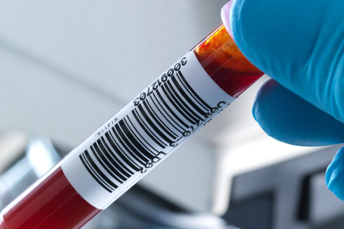 Image of a blood sample vail