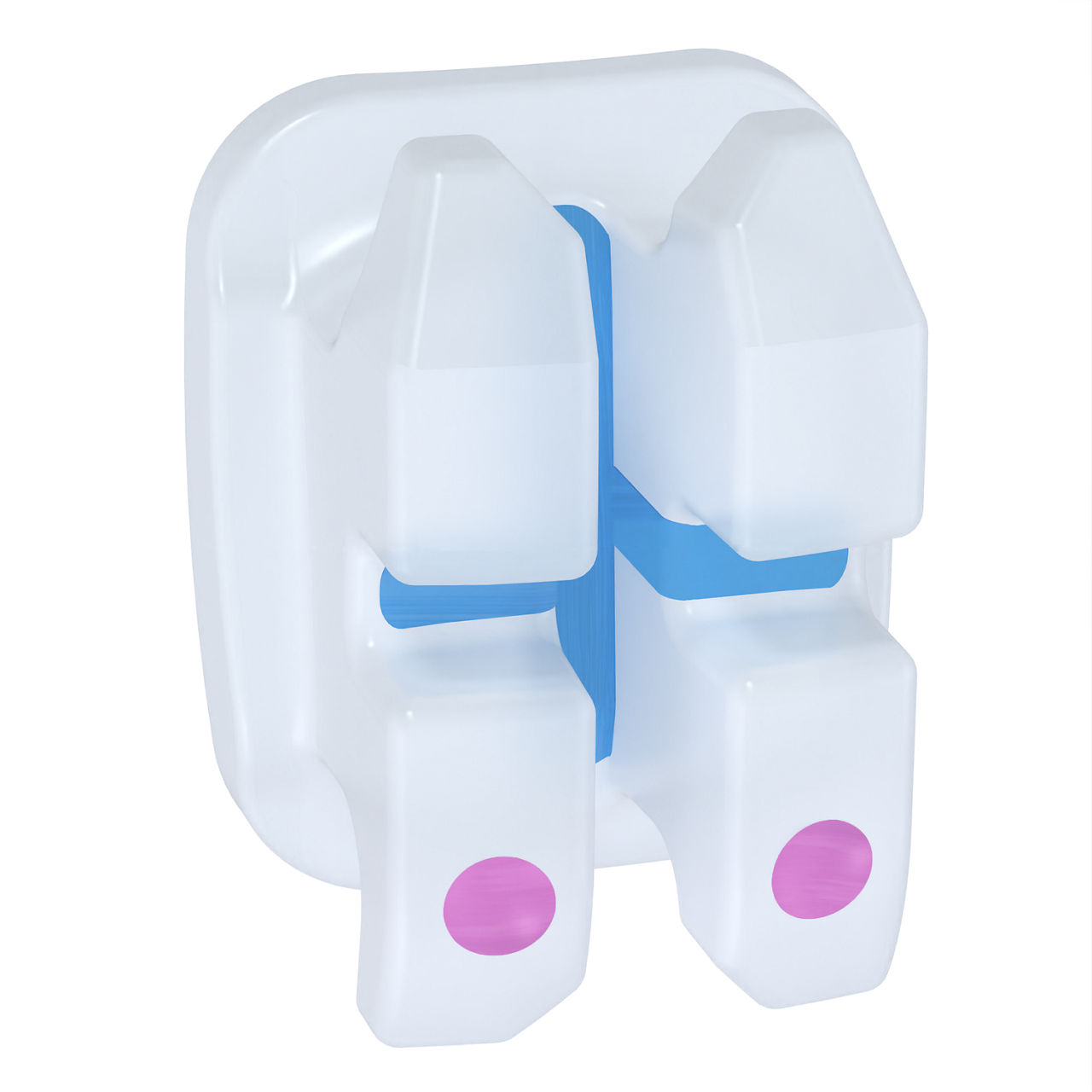 3M™ Clarity™ Advanced Ceramic Brackets, 4006-250, APC™ Flash-Free, .018,L1-2, -6T/0A, 5/Pk