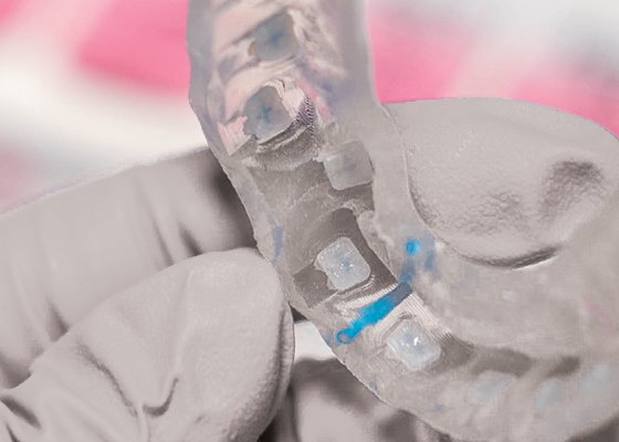 Informative oral care related imagery with a file name of 03.jpg shown on Solventum's "Brain Floss" blog