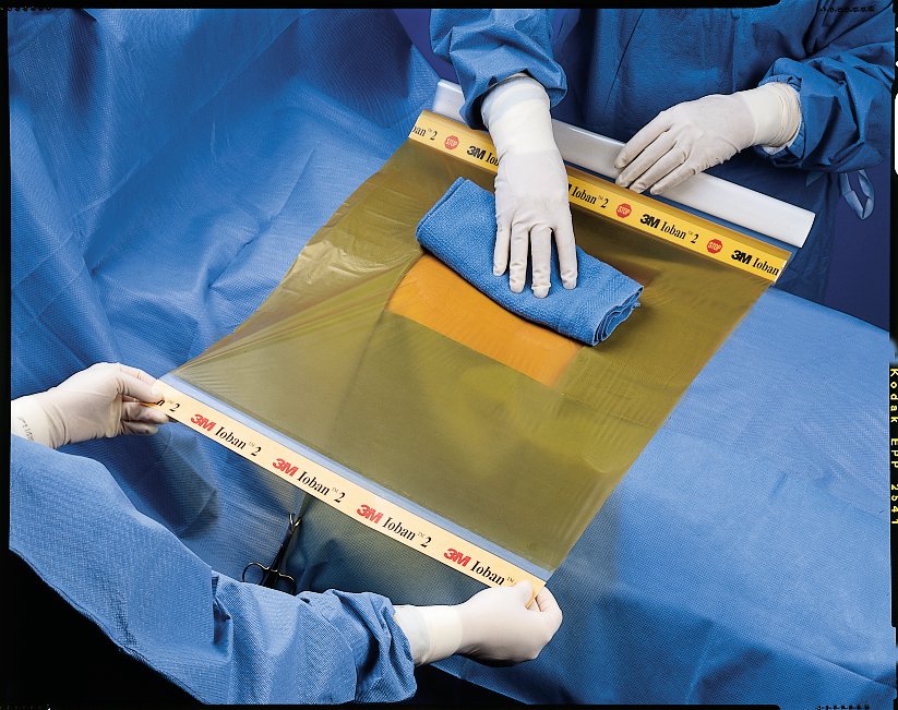 Ioban 2 Antimicrobial Incisions Adhesive Film