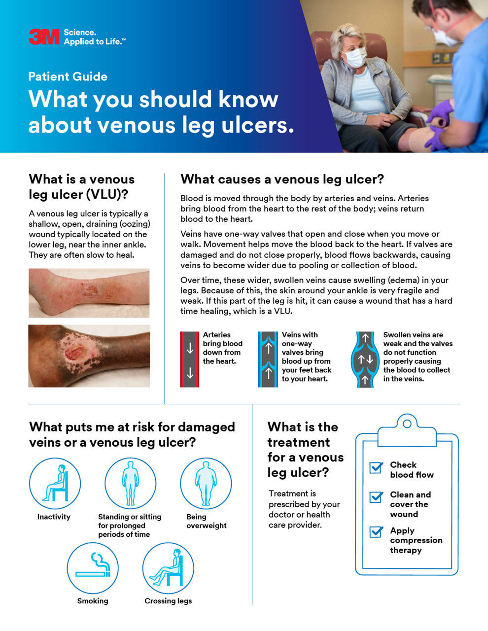 What you should know about venous leg ulcers cover preview