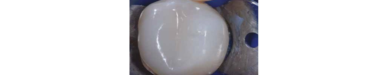 close up tooth