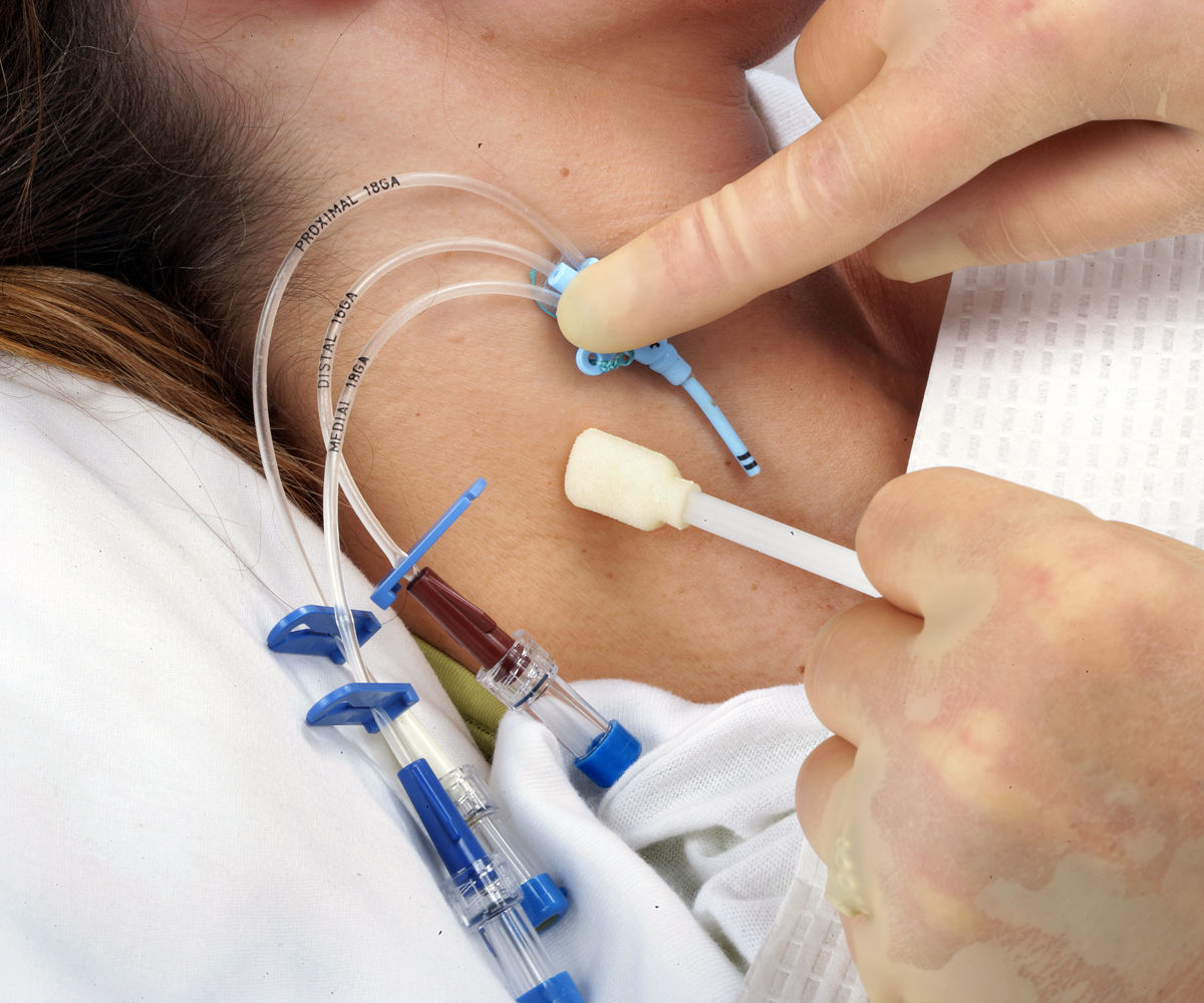 1655 CVC, Cavilon Płyn barierowy bez alkoholu, Tegaderm IV Opatrunek z folii przezroczystej, aplikacja, jpg, szyja, 70-2009-7494-0