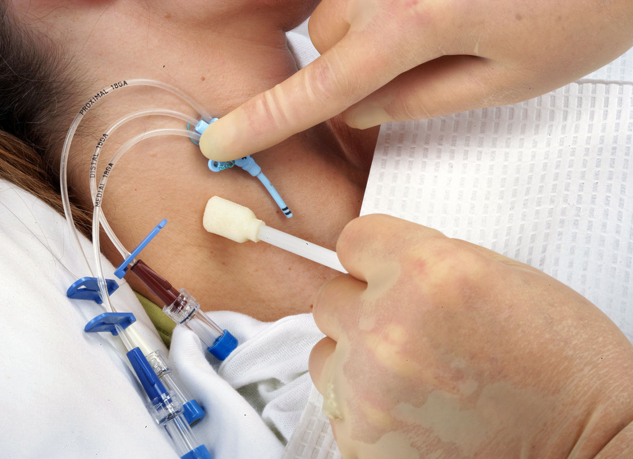 1655 CVC, Cavilon No Sting Barrier Film, Tegaderm IV Transparent Film Dressing, påføring, jpg, hals, 70-2009-7494-0