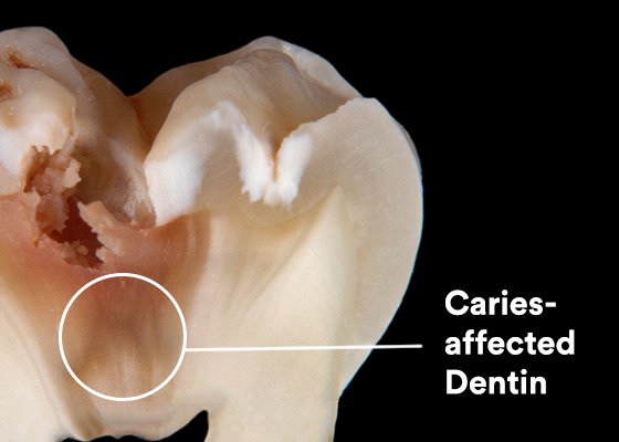 Informative oral care related imagery with a file name of Alberto-Ferreiroa_Headshot.jpg shown on Solventum's "Brain Floss" blog