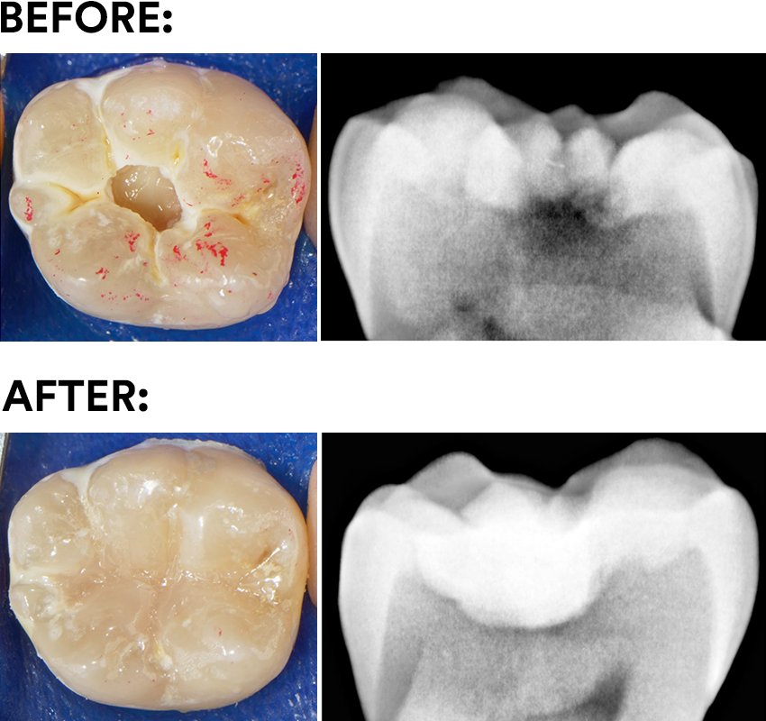 Informative oral care related imagery with a file name of Alwin-van-Daelen.jpg shown on Solventum's "Brain Floss" blog