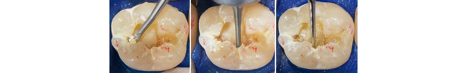 Informative oral care related imagery with a file name of 07.jpg shown on Solventum's "Brain Floss" blog