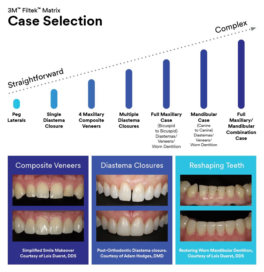 Informative oral care related imagery with a file name of Finishing-Spirals_850x335.jpg shown on Solventum's "Brain Floss" blog