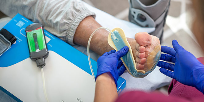 Customizable options because every wound is unique