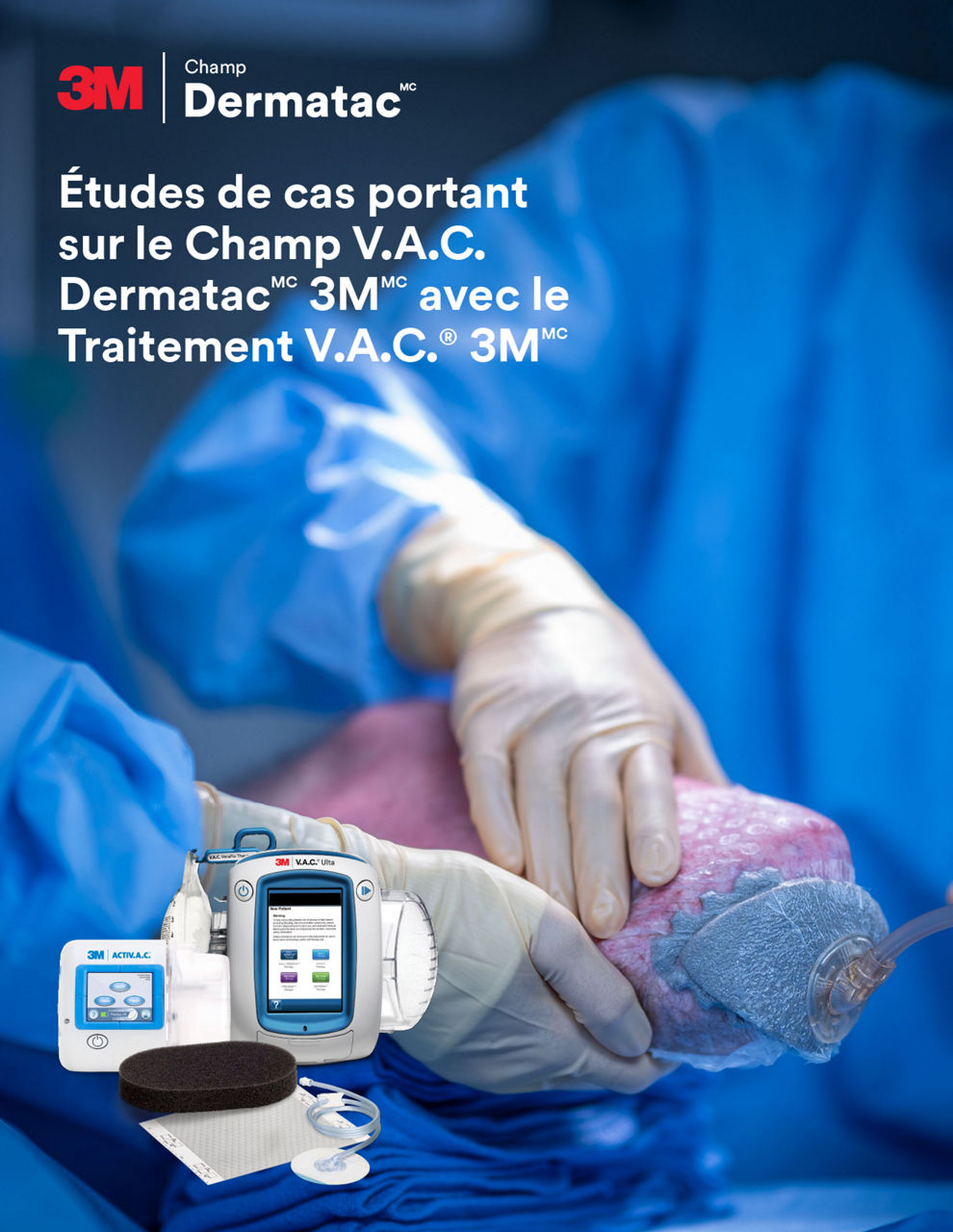 Études de cas sur la thérapie V.A.C. – aperçu